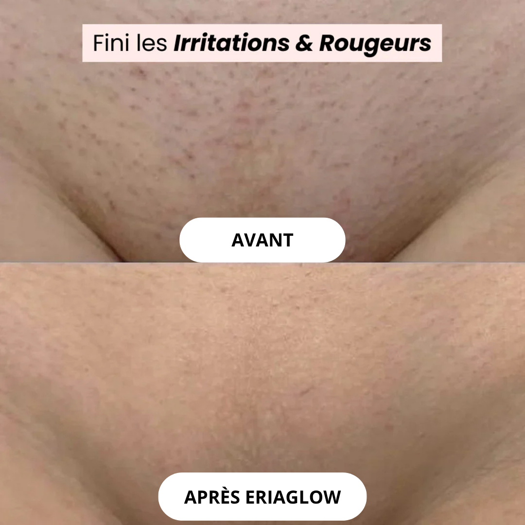 Rasoir Eriaglow® - L’innovation du rasage pour une peau douce et saine