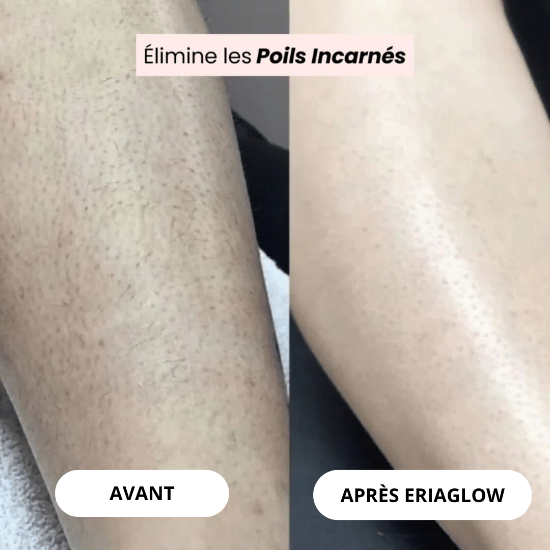 Rasoir Eriaglow® - L’innovation du rasage pour une peau douce et saine